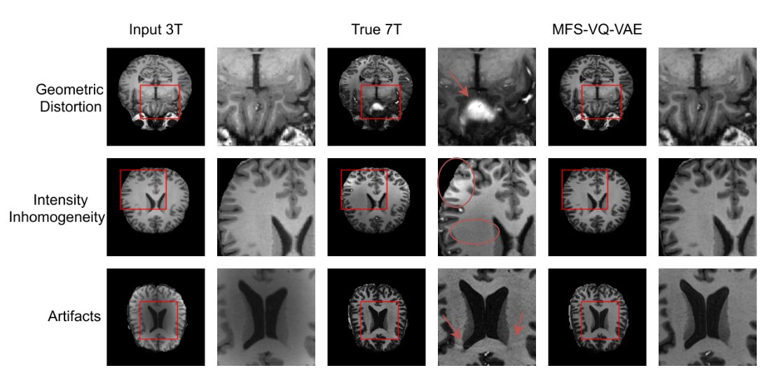 Magnetic field inhomogeneity correction